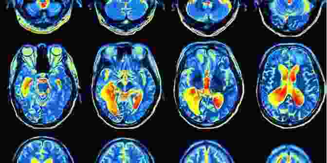 Brain Scan Showing Activity During Marketing Stimuli The Attention Merchants: The Epic Scramble To Get Inside Our Heads