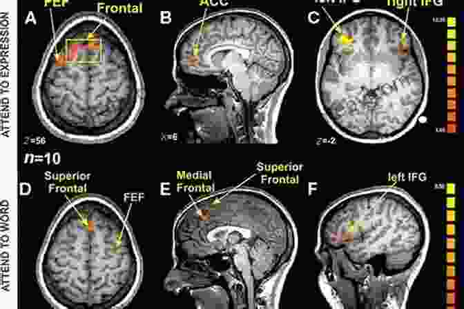 FMRI Brain Scan Showing Activation In Response To A Marketing Message The Attention Merchants: The Epic Scramble To Get Inside Our Heads